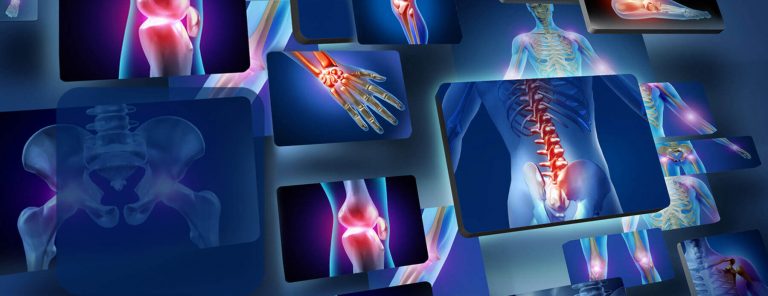 Chiropractic-Background : Painless Chiropractic and Neuropathy